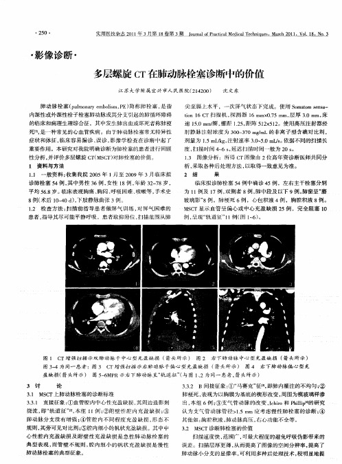多层螺旋CT在肺动脉栓塞诊断中的价值