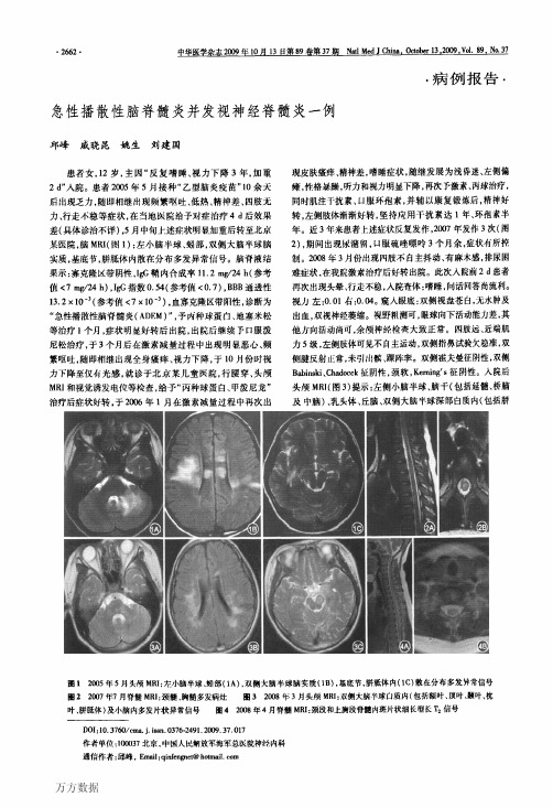 急性播散性脑脊髓炎并发视神经脊髓炎一例2009-戚晓昆