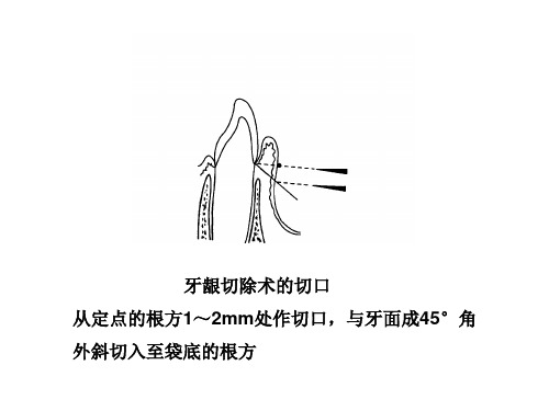 --牙周病学第四版10
