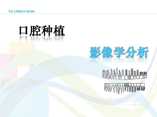 口腔种植-影像学分析