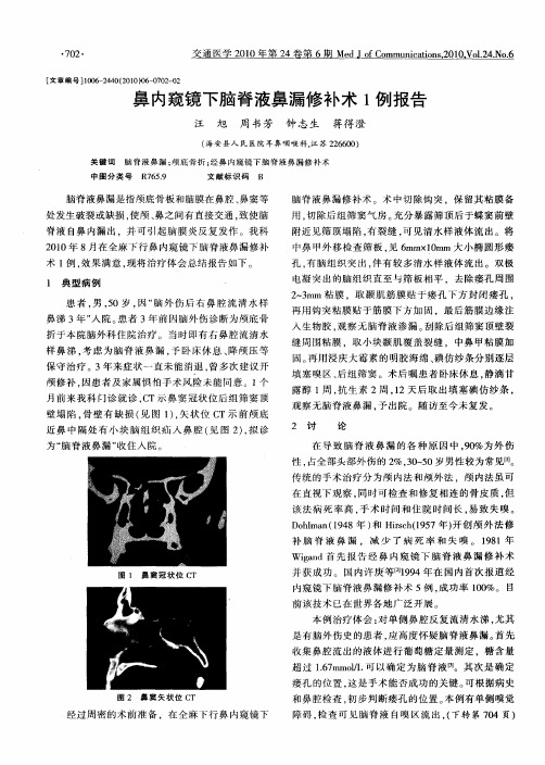 鼻内窥镜下脑脊液鼻漏修补术1例报告