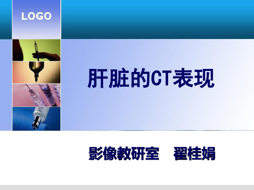 肝脏的CT诊断