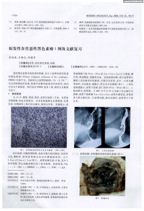 原发性食管恶性黑色素瘤1例及文献复习