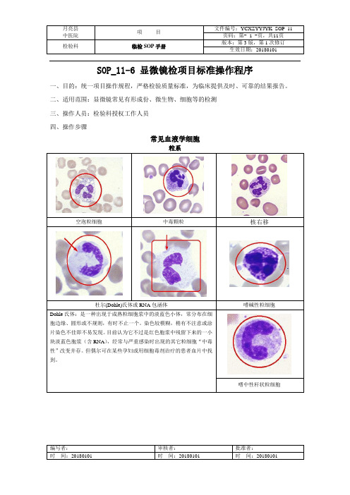 显微镜检项目标准操作程序