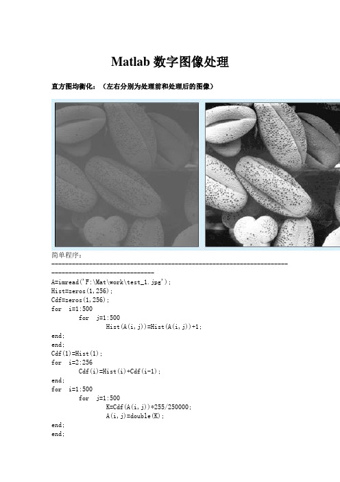 Matlab数字图像处理