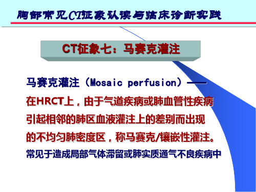 爱爱医资源-马赛克灌注征