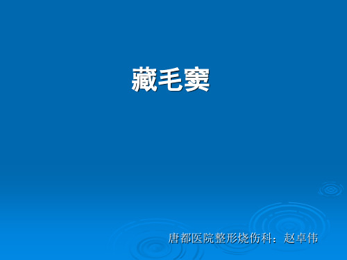 藏毛窦