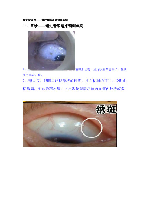 教大家目诊——通过看眼睛来预测疾病