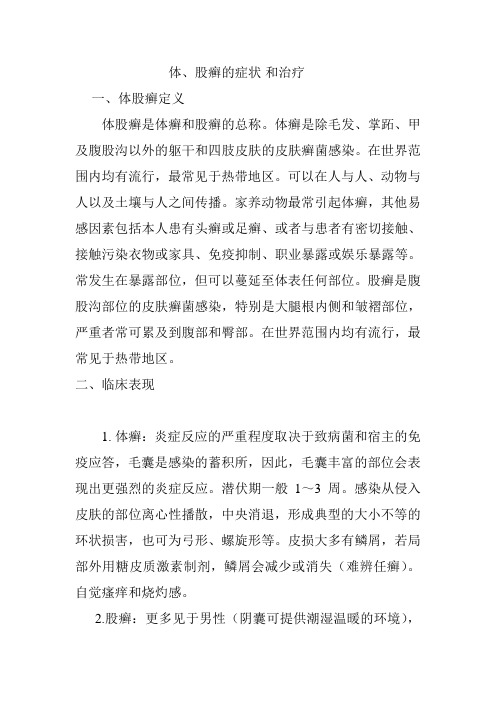 体、股癣的症状 和治疗