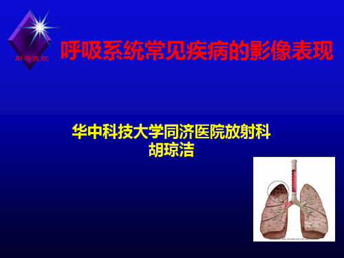 医学影像学-肺部疾病PPT课件