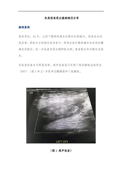 非典型表现白塞病病历分享