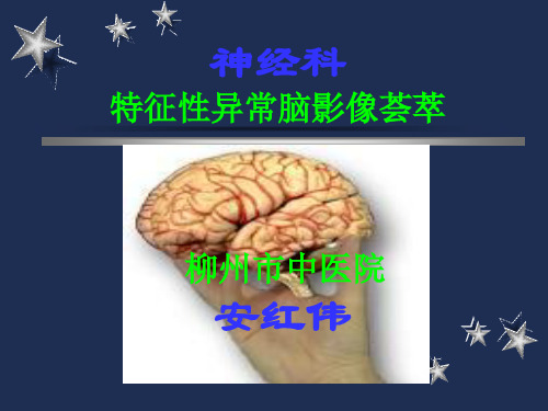 神经科特征性脑影像荟萃