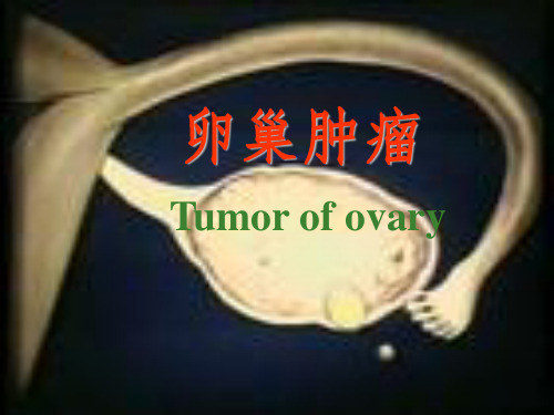 卵巢肿瘤ppt课件