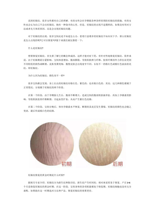 妊娠纹修复你要知道的常识