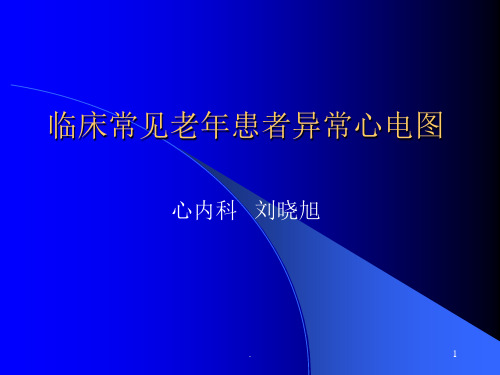 常见异常心电图诊断演示文稿