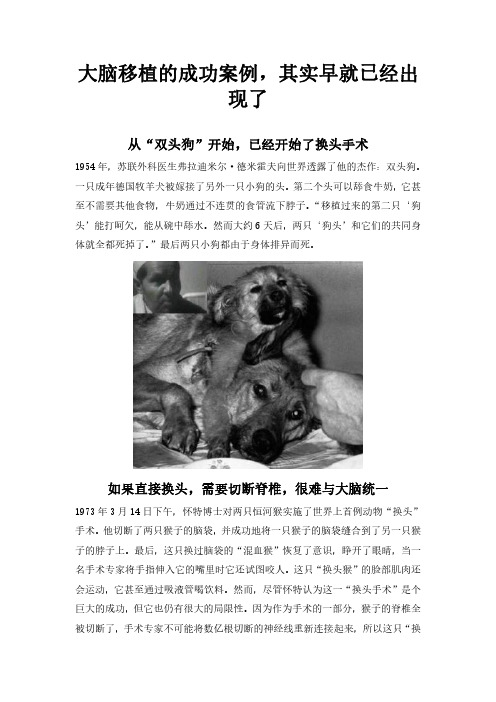 移植大脑已有成功案例,头颅移植手术再现