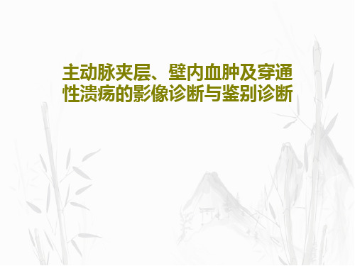 主动脉夹层、壁内血肿及穿通性溃疡的影像诊断与鉴别诊断共71页文档