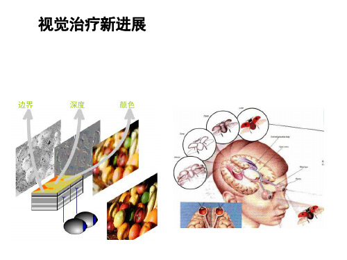 弱视治疗新进展