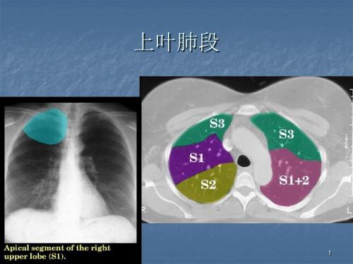 胸部CT诊断PPT课件