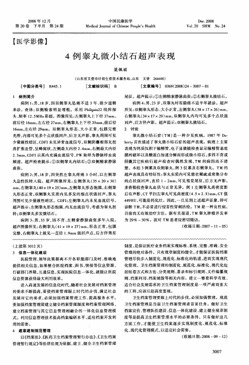 4例睾丸微小结石超声表现