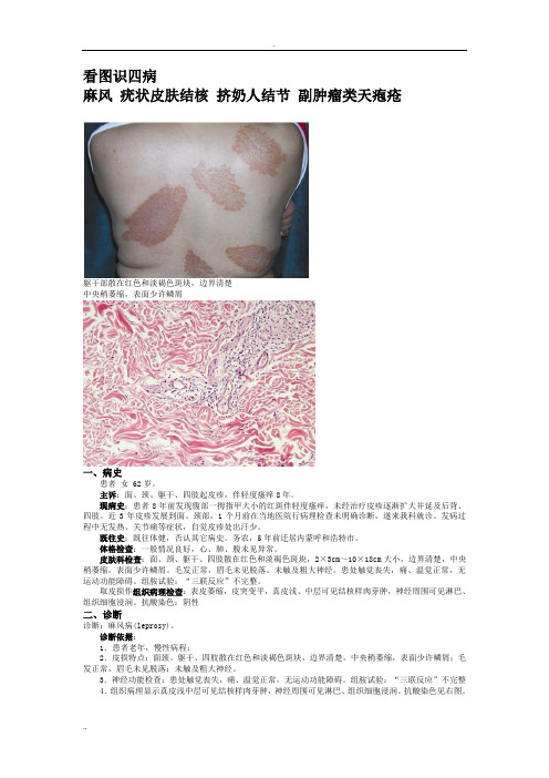 看图识皮肤病四种
