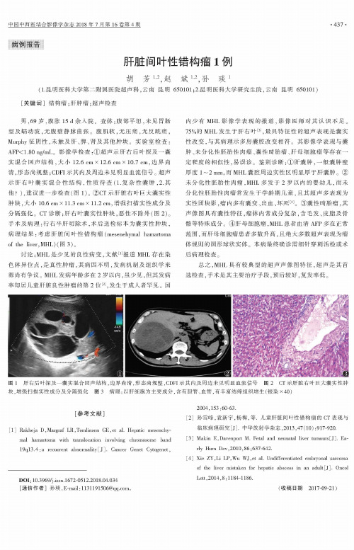 肝脏间叶性错构瘤1例