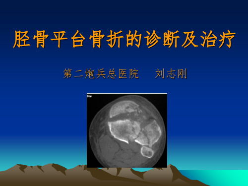 胫骨平台骨折的诊断及治疗精选ppt