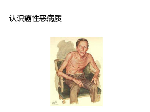 认识癌性恶病质