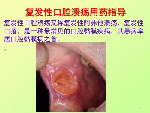 复发性口腔溃疡用药指导PPT课件