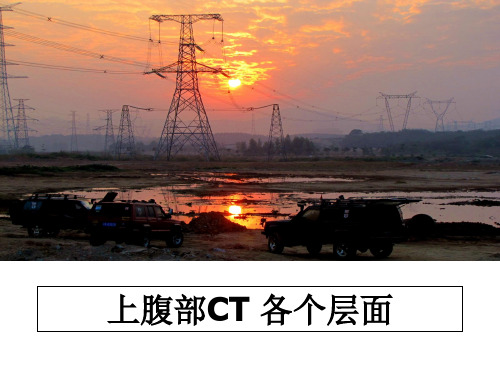 最新上腹部CT 各个层面ppt课件