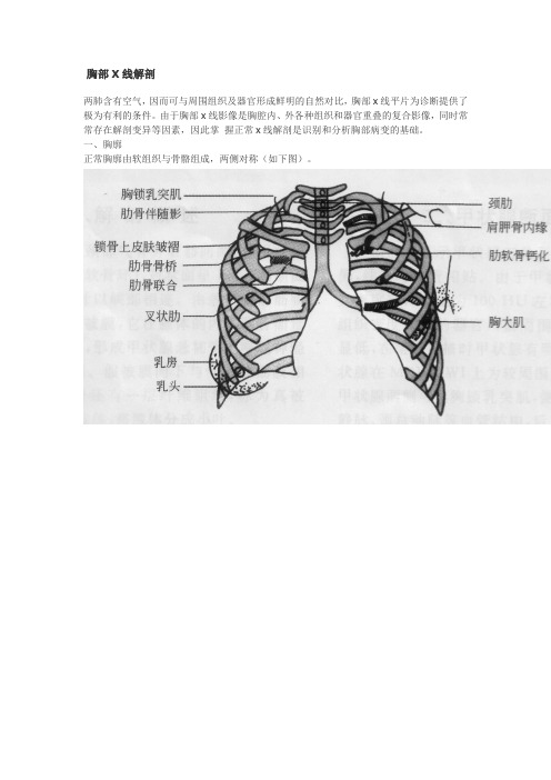 胸部x线片