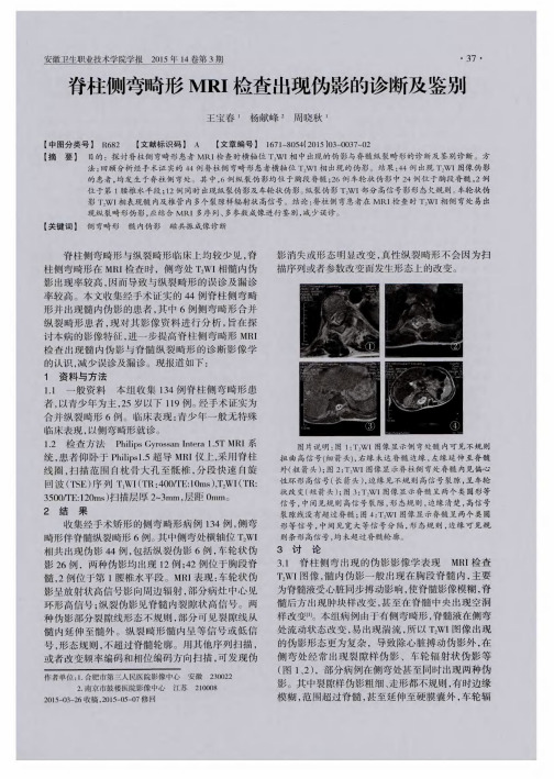 脊柱侧弯畸形MRI检查出现伪影的诊断及鉴别