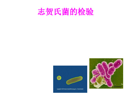 志贺氏菌检验