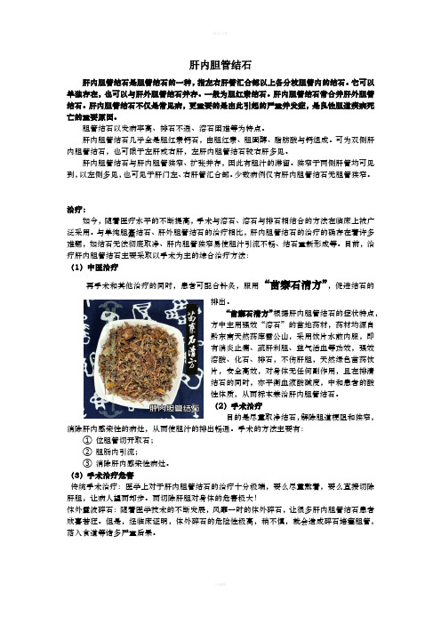肝内胆管结石最佳治疗方法