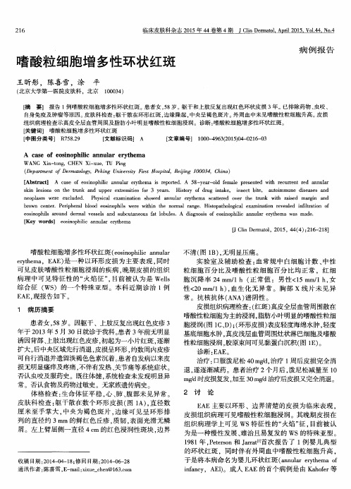 嗜酸粒细胞增多性环状红斑