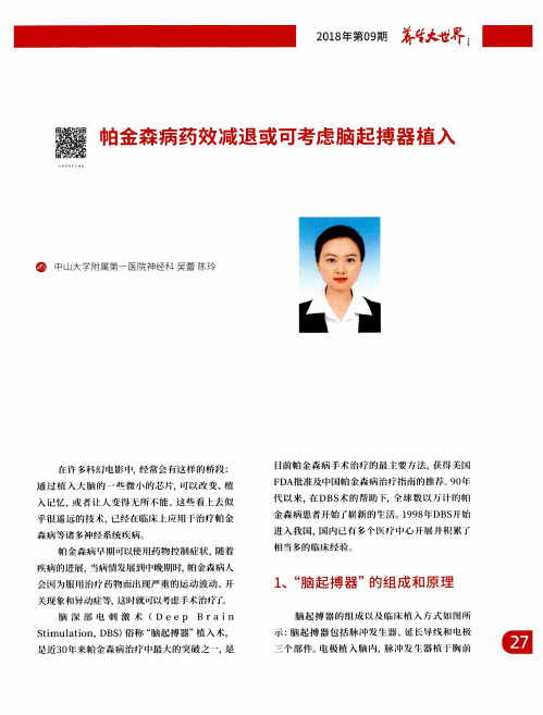 帕金森病药效减退或可考虑脑起搏器植入