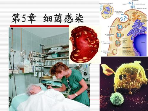 5-细菌的感染2012