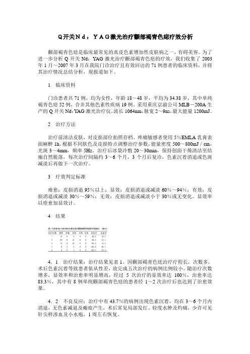 Q开关Nd：YAG激光治疗颧部褐青色痣疗效分析