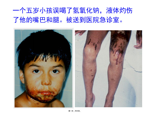 皮肤损伤修复经典讲座(附图和实例)