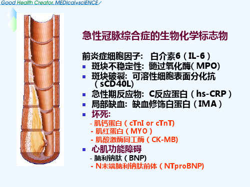 超敏cTnI-