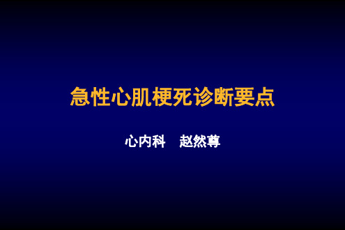 急性心肌梗死诊断要点