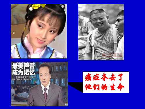 恶性肿瘤的病因