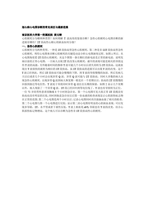 冠心病心电图诊断的常见误区与最新进展