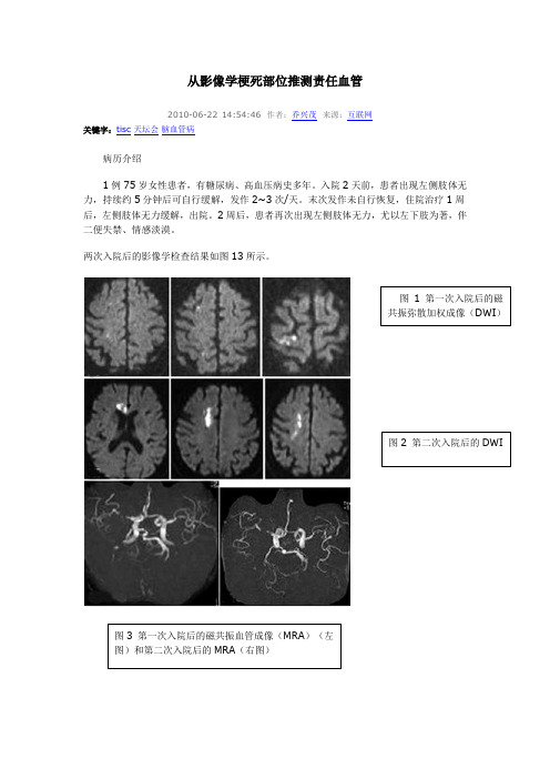 从影像学梗死部位推测责任血管