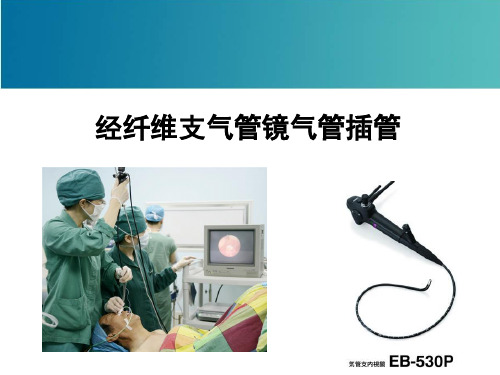 经纤维支气管镜气管插管(PPT课件)