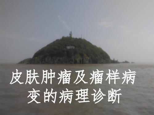 皮肤肿瘤及瘤样病变的病理诊断ppt课件