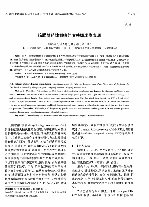 脑脱髓鞘性假瘤的磁共振成像表现