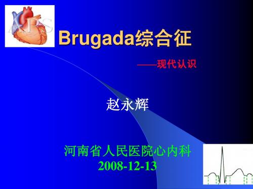 Brugada综合征4