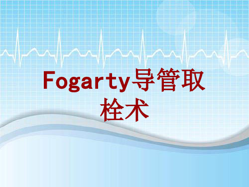 手术讲解模板：Fogarty导管取栓术