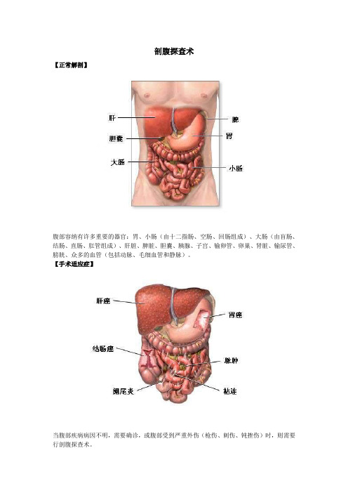 剖腹探查术